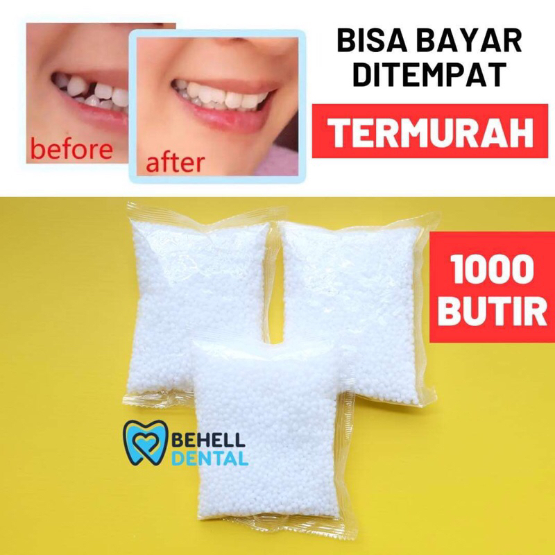 GIGI PALSU SEMENTARA 1000 BUTIR / PENAMBAL GIGI PATAH RENGGANG TEMPORARY TOOTH TEMPTOOTH GINGSUL PAT