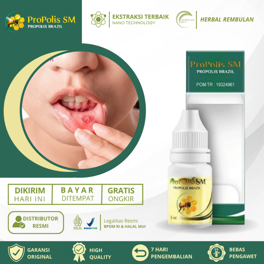 Obat Sariawan, Sariawan Di Bibir Mulut Dan Lidah, Obat Tetes Sariawan Mulut, Obat Panas Dalam, Obat 