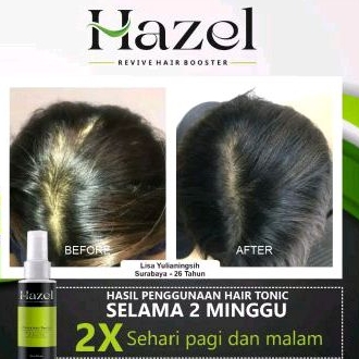 hazel hair tonic penumbuh rambut cepat dan ampuh 60 ml
