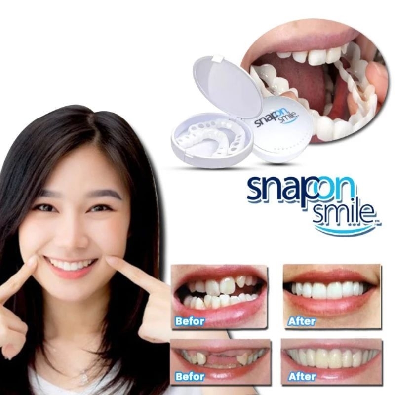 [LA] Snap On Smile Veneer inopatif Original 100%