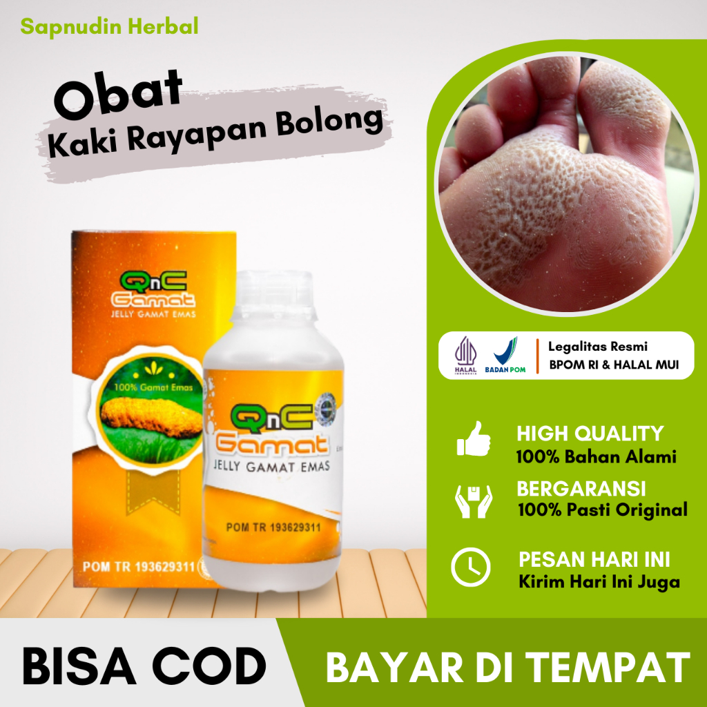 Obat Kaki Rayapan / Pitted Keratolysis - Obat Kaki Berlubang - Obat Kaki Rorombeheun - Obat Telapak 