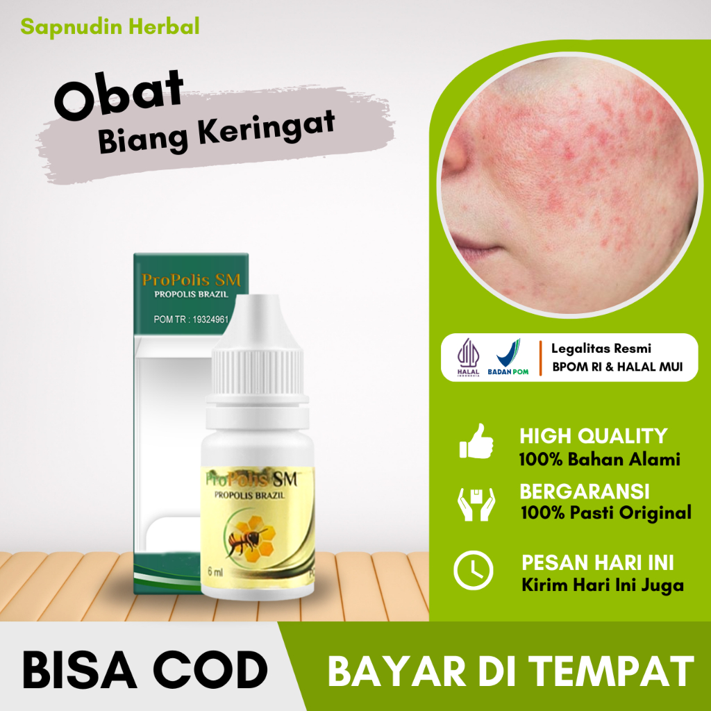Obat Biang Keringat, Obat Ruam Kecil Kemerahan, Obat Gatal Buntusan, Obat Kulit Terbakar, Obat Ruam 