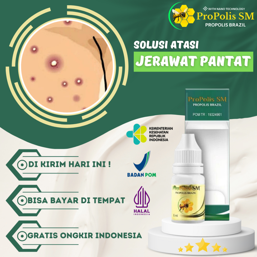 Obat Gatal Pantat Dan Selangkangan,Bruntusan di Pantat, Jerawat Pantat, Obat Gatal Pantat Bokong, Ob