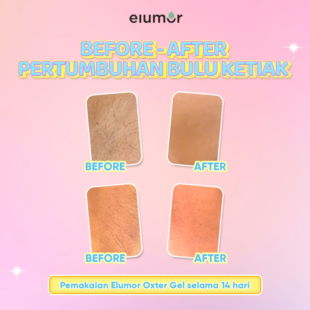 Bundle Oxter Gel New Formula 50g + Elumor Oxter Cream 30g | Deodorant &amp; Krim Pemutih Ketiak