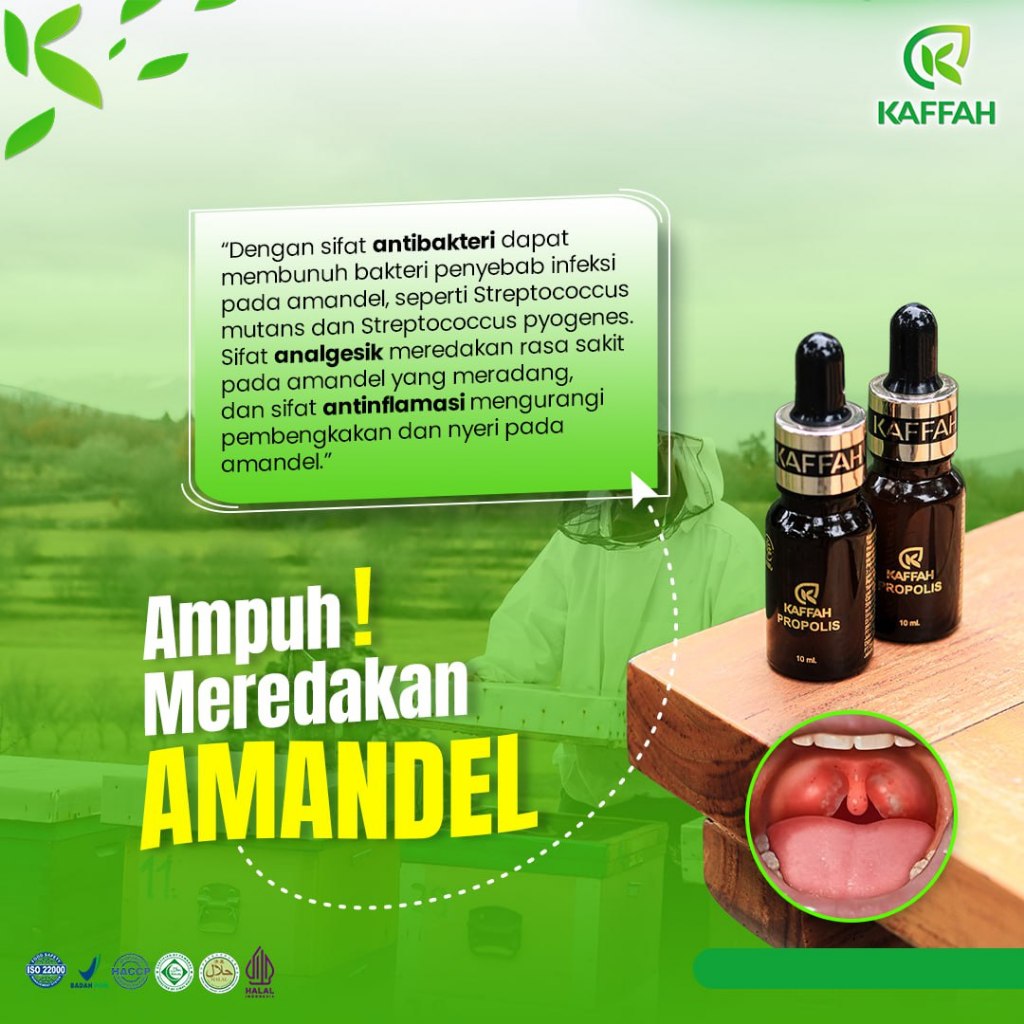 Kaffah Propolis Ampuh Meredakan Amandel Tanpa Operasi
