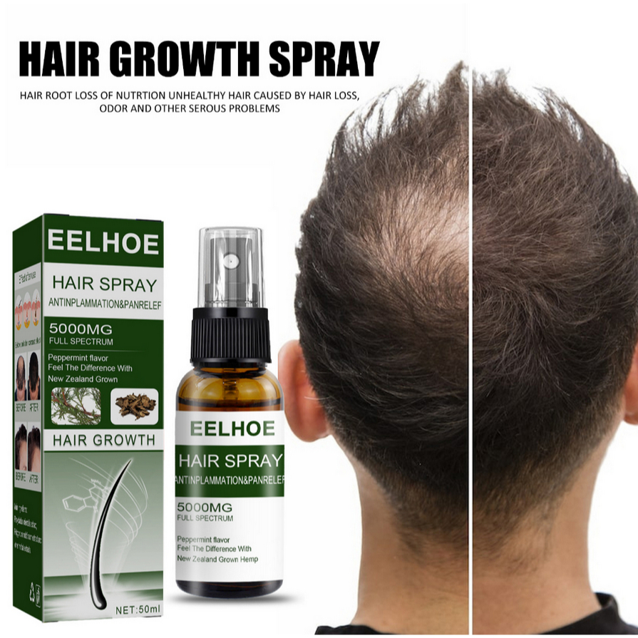 EELHOE HAIR SPRAY/GINGER HAIR HEALTH SPRAY EELHOE Penumbuh rambut 50ML Scalp Repair/Rapid hair growt