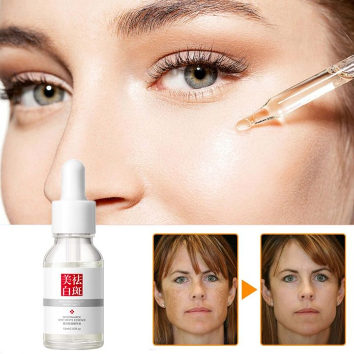 FUYAN Nicotinamide Whitening Serum Freckles Remove Dark Spots Melasma (CM001)