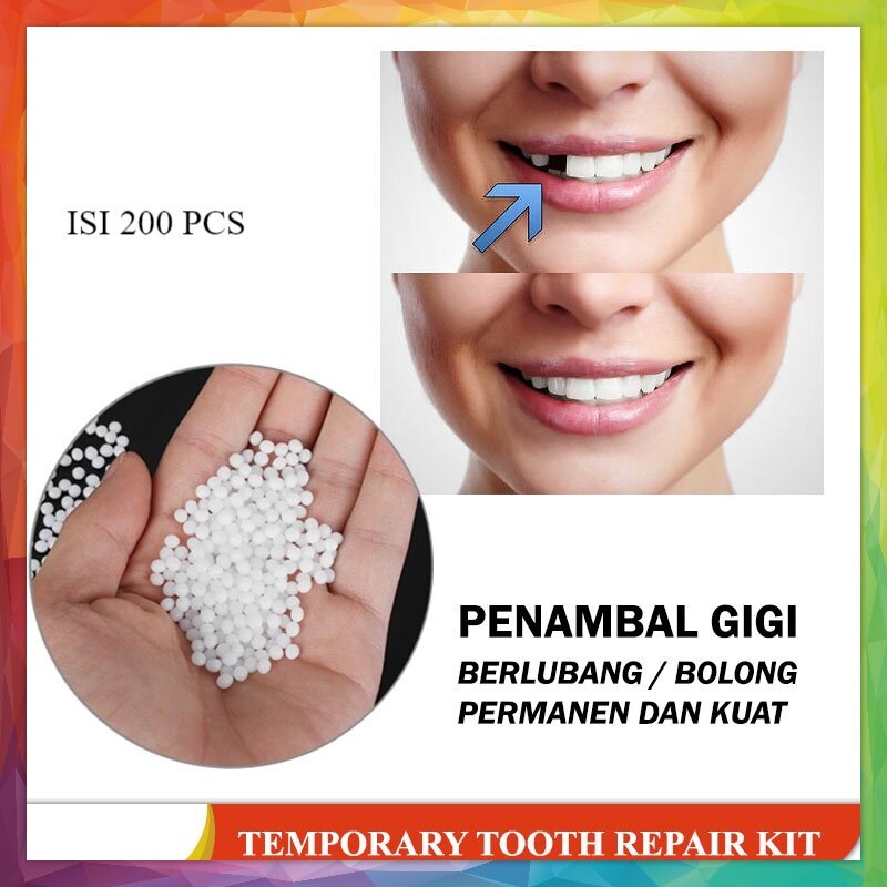 GIGI PALSU SEMENTARA 200 BUTIR / PENAMBAL GIGI PATAH RENGGANG TEMPORARY TOOTH TEMPTOOTH GINGSUL PATA