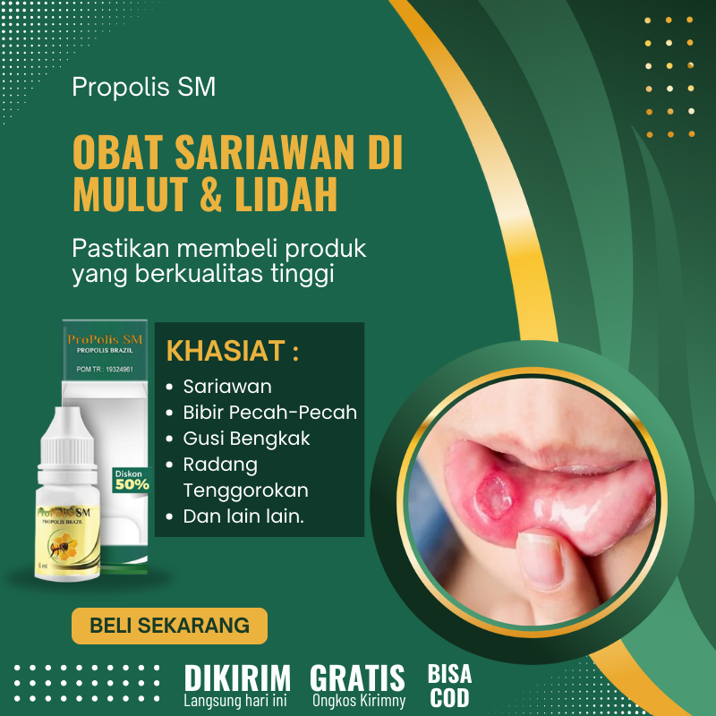 Obat Sariawan Menahun, Obat Tetes Sering Sariawan, Obat Penyembuh Sariawan Perih Tak Kunjung Sembuh,