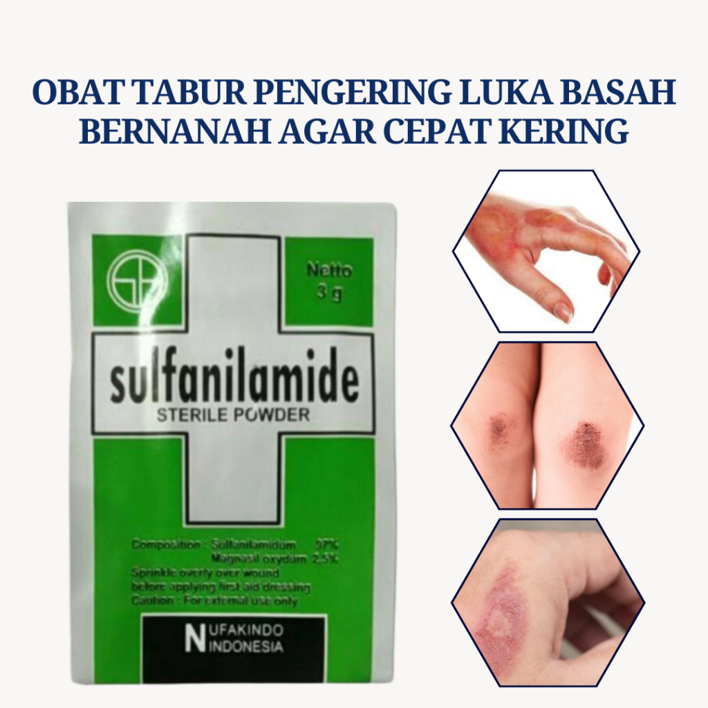 Bedak Pengering Luka Basah Bernanah Koreng Obat Luka Bakar Kena Knalpot Air Panas Ampuh Langsung Cep