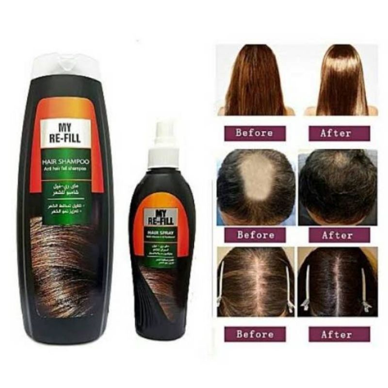 ✨JUAL MURAH✨ Shampoo Refil My Way / Shampoo My Way Anti Rontok / Hair Spray My Way