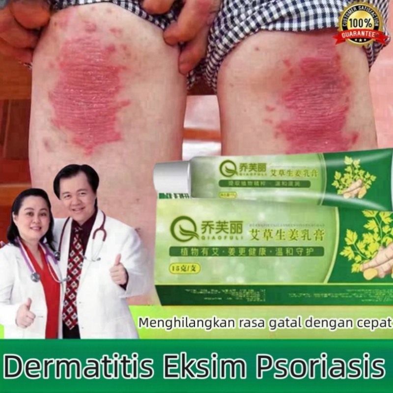 Salep Gatal Paling Ampuh obat gatal kulit obat jamur kulit Krim Herbal Untuk Eksim Krim psoriasi Ana