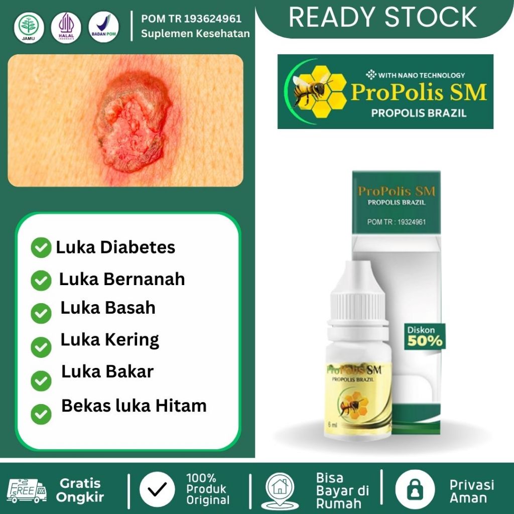 Obat Luka Diabetes Pengering Luka Diabetes Luka Diabetes Basah Luka Diabetes Bernanah Luka Bakar Bek