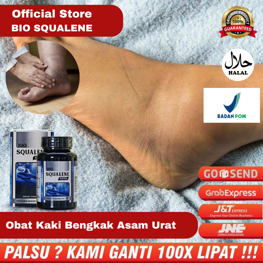 Obat Kaki Bengkak Penumpukan Cairan, Obat Kaki Bengkak Asam Urat, Obat Kaki Bengkak Karena Diabetes,