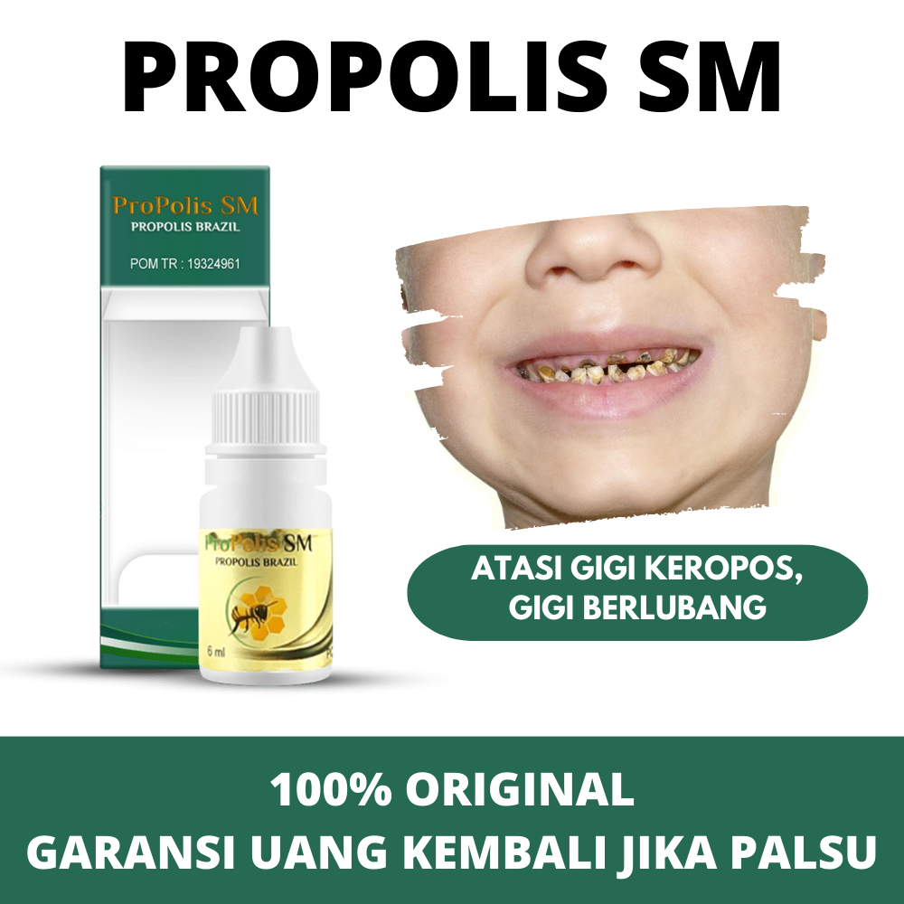 Obat Gigi Keropos , Obat Gigi Berlubang -Obat Tetes Kumur Atasi  Gigi kuning , Anak & Dewasa Herbal 
