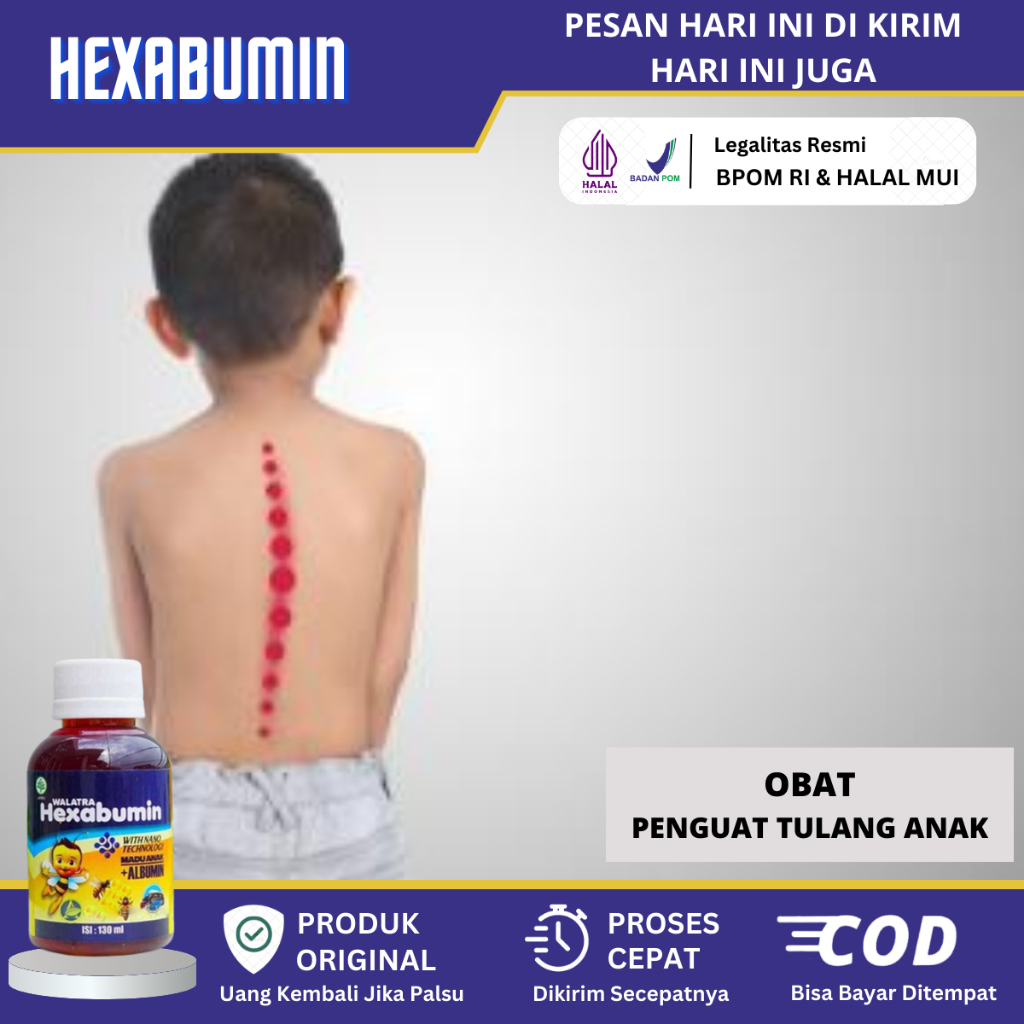 Obat Vitamin Penguat Tulang Anak, Obat Anak Terlambat Berjalan, Obat Peningkat Pertumbuhan Tulang An