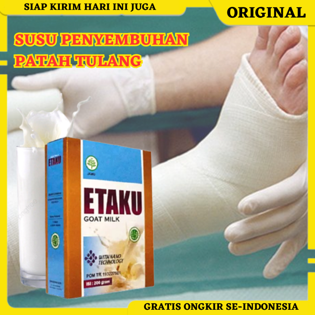 Susu Untuk Patah Tulang, Obat Tulang Retak, Obat Tulang Bergeser, Obat Tulang Keropos, Obat Tulang R