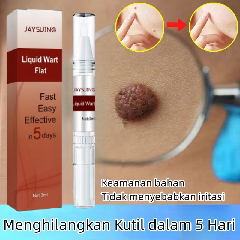 Penghilang kutil wart remover pen Penghilang Tahi Lalat Penghilang Kutil Skin Tag Remover Menghilangkan Tahi Lalat