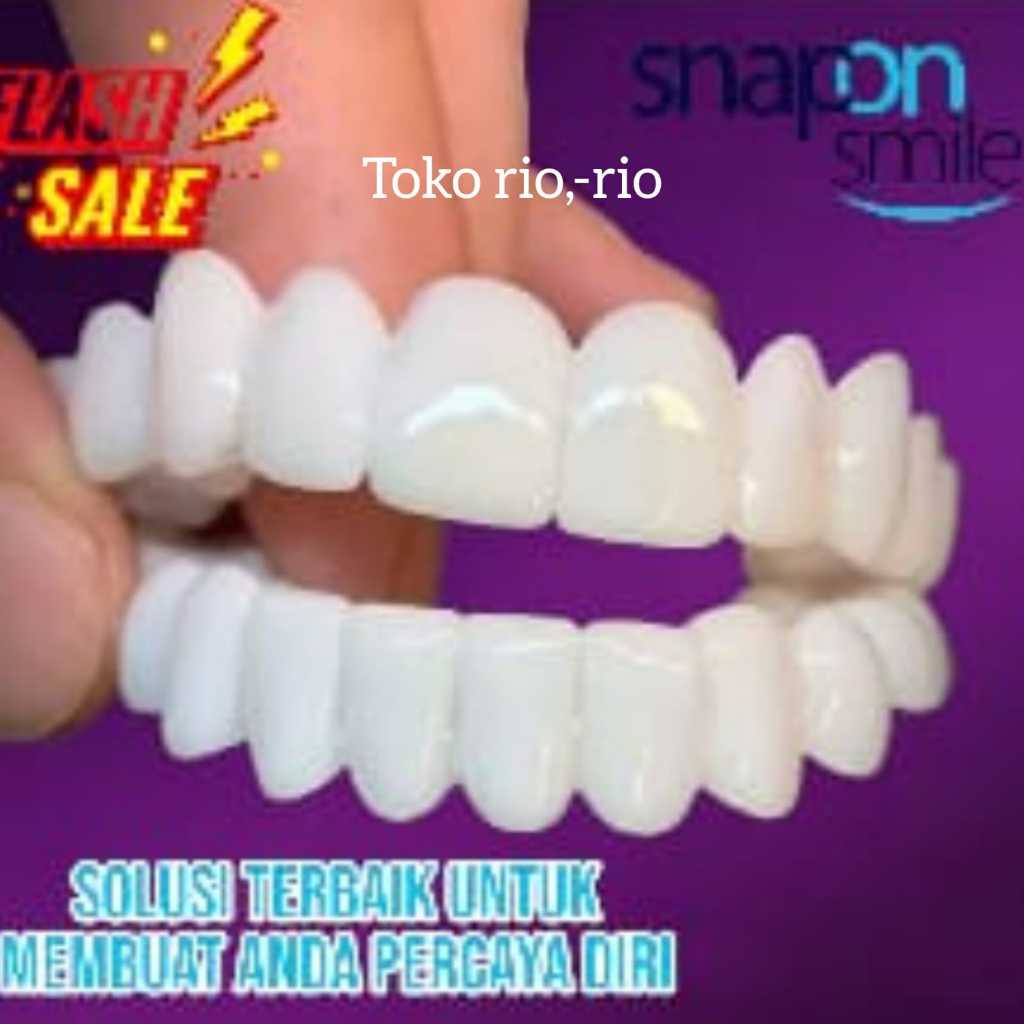 Snap On Smile 100% Original Authentic