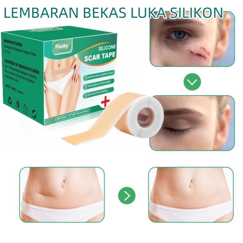 Silicone Scar Sheet 4cm x 1.5m plester Scar Removal Silicone Tape Penghilang bekas luka keloid penghilang strechmark