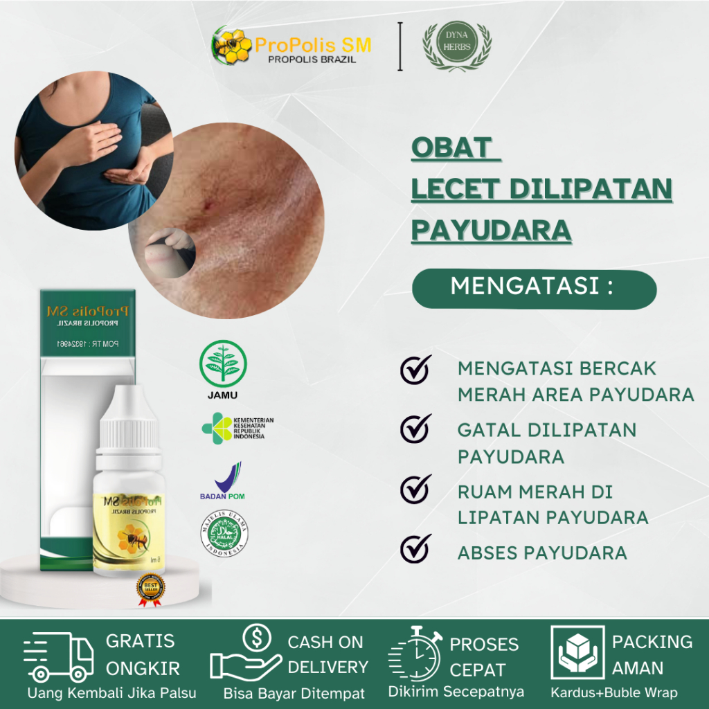 Obat Oles Gatal Lipatan Payudara, Obat Abses Payudara, Obat Payudara Bengkak, Obat Gatal Payudara, O