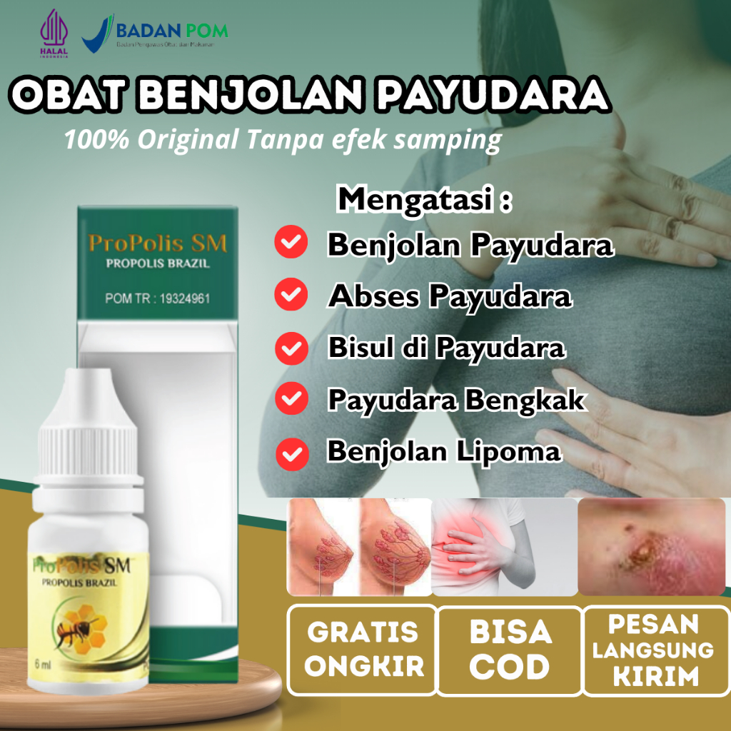 Pengempis Benjolan di Payudara, Obat Nyeri Payudara, Obat Bisul di payudara, Obat Abses payudara, Ob