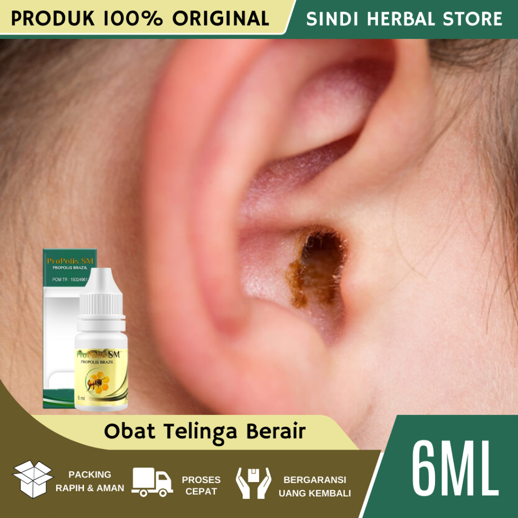 Obat Tetes Kotoran Telinga Keras, Obat Pelunak Kotoran Telinga Anak dan Dewasa, Obat Penghancur Koto