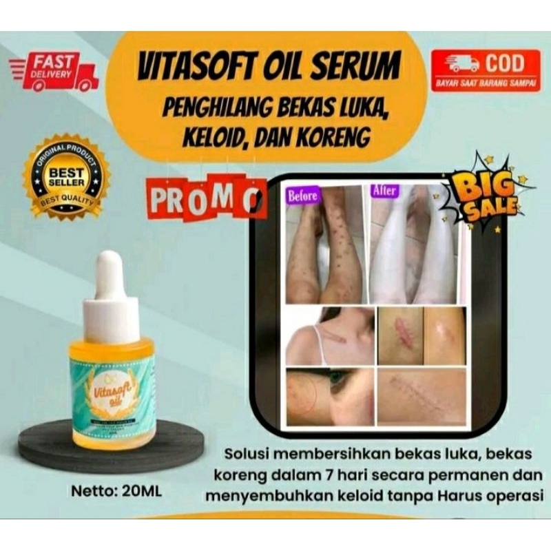 penghilang bekas luka vitasoft oil secara permanen