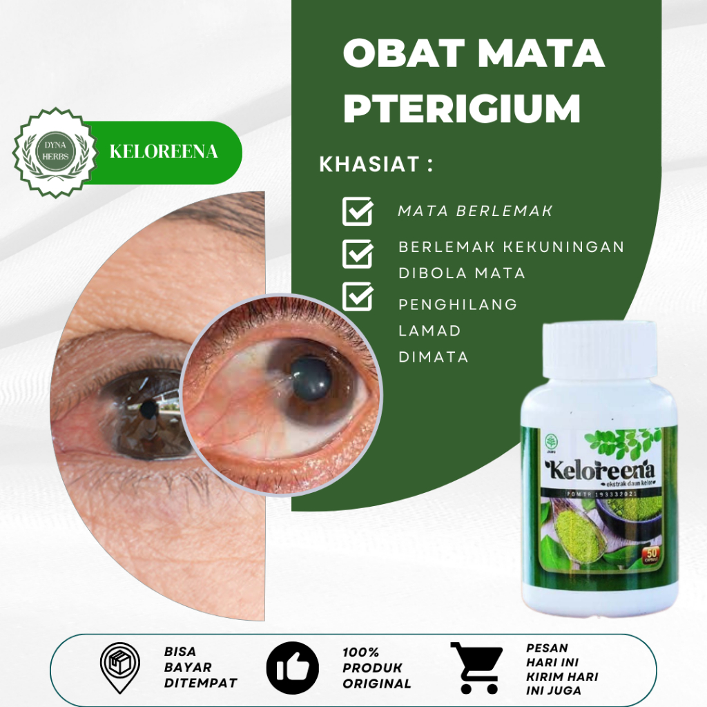 Obat Mata Berlemak, Obat Ptregium Kekuningan, Obat Pembersih Pterigium, Obat Mata Kekuningan, Obat V
