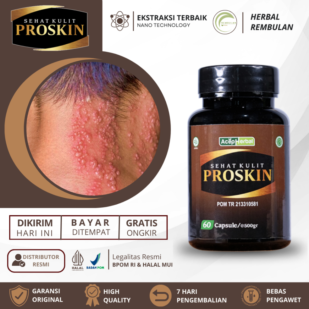 Obat Herpes, Obat Herpes Kulit, Obat Herpes Zoster, Obat Gatal Kulit Herpes, Obat Herpes Kelamin, Ob