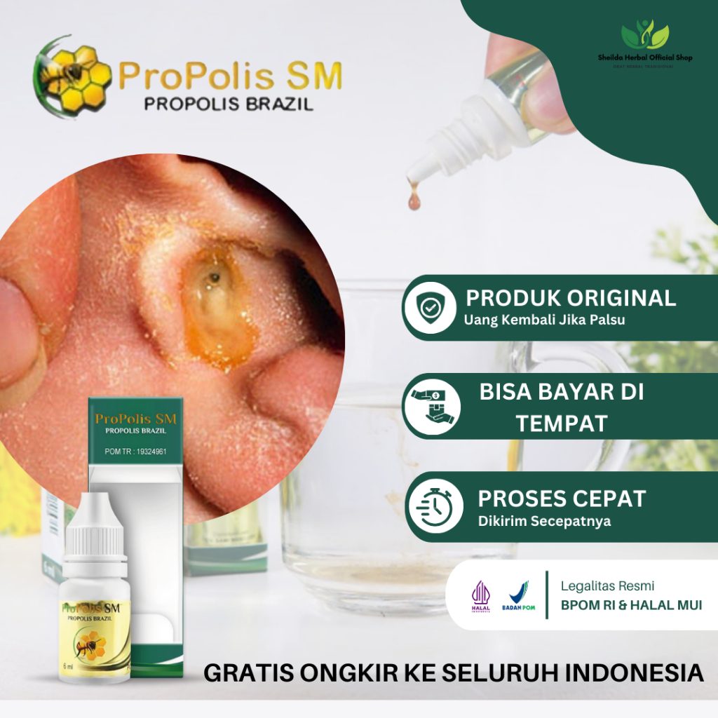 Obat Telinga Gatal, Obat Daun Telinga Gatal, Telinga Gatal Dan Berair, Telinga Bernanah, Infeksi Jam