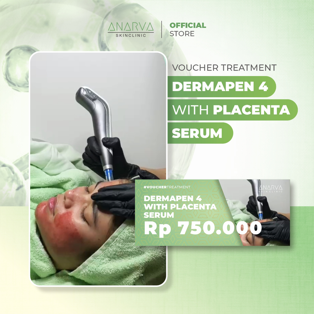 Rejuvenation with Dermapen 4