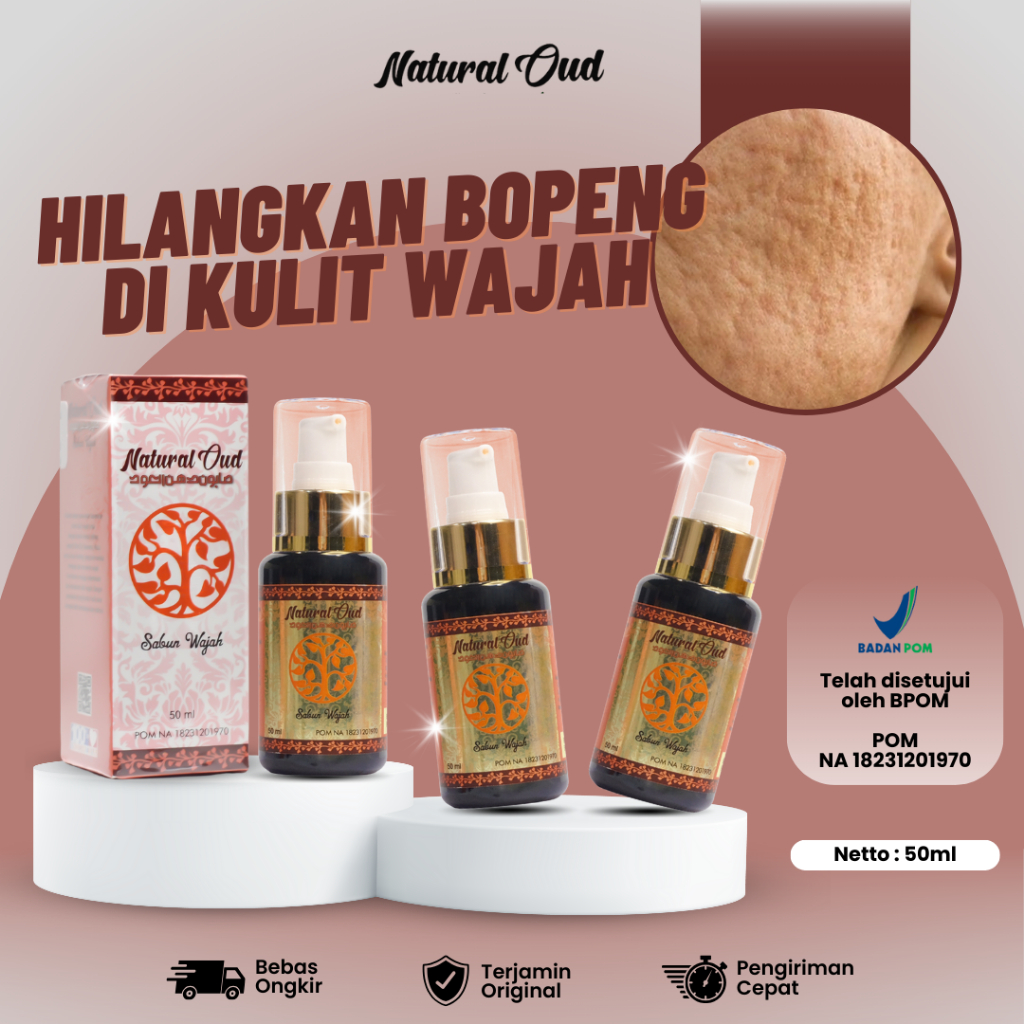 Sabun Natural Oud Penghilang Bopeng, Cara Alami Menghilangkan Bopeng, Sabun Pembersih Bopeng , Obat 