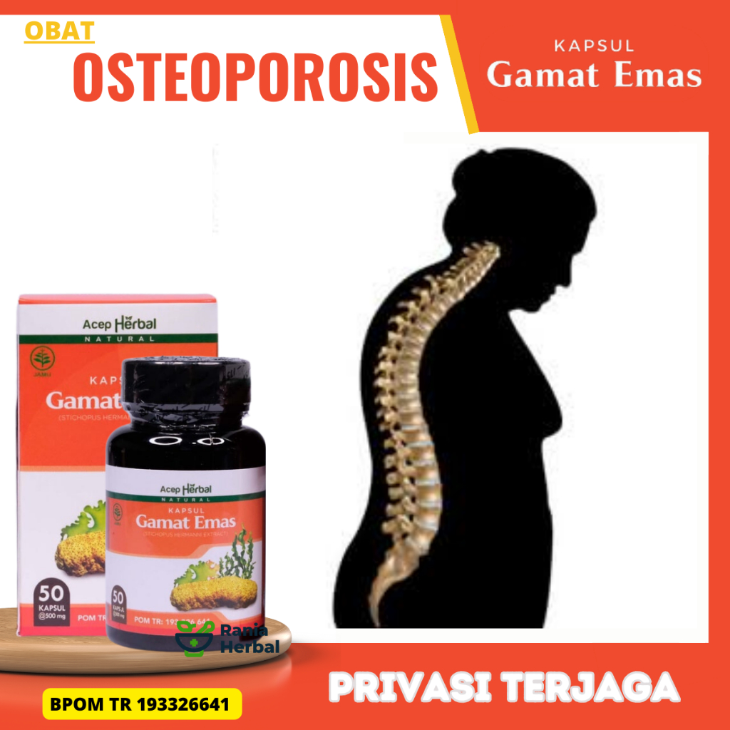 Obat Osteoporosis, Obat Tulang Keropos, Obat Pengapuran Tulang, Obat osteoporosis pengeroposan tulan