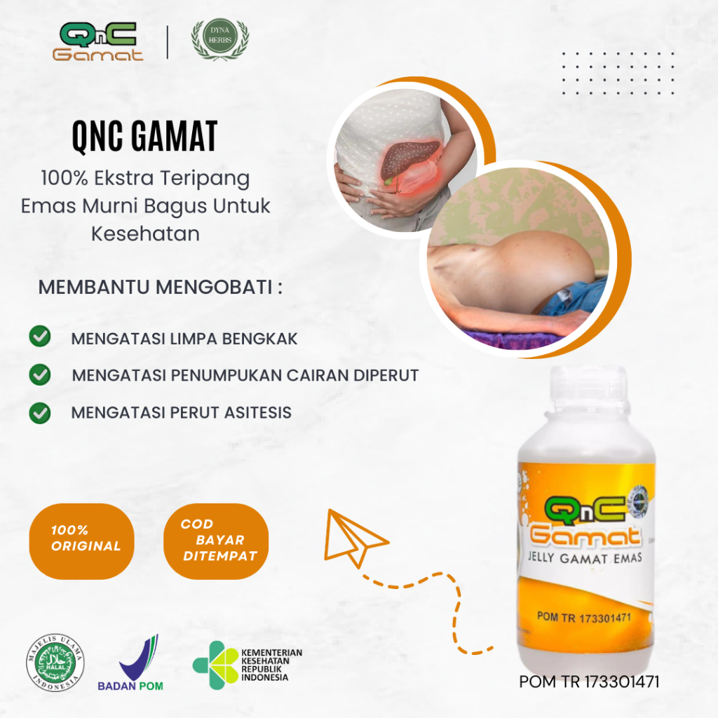 Obat Untuk Limpa Bengkak, Obat Asites Perut Bengkak, Obat Liver Perut Membesar, Obat Perut Membesar,
