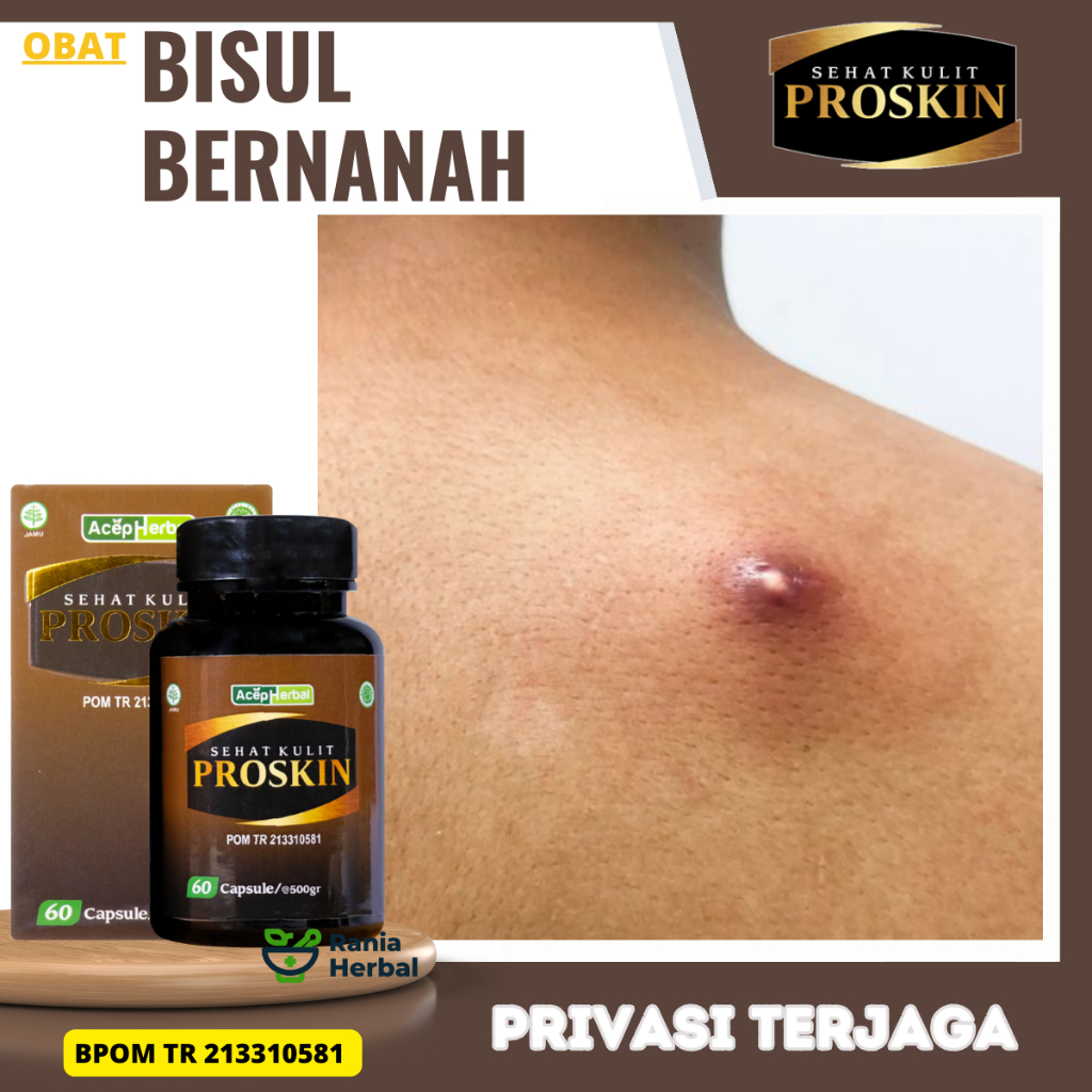 Obat Bisul Bernanah, Obat Cenang Bernanah, Obat Infeksi Kulit, Obat Penghilang Bintik Berair, Obat C