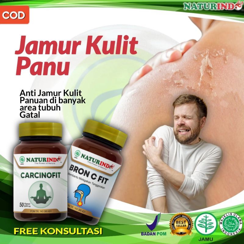 Obat Panu Alami Paling Ampuh Cepat Hilang Permanen Untuk Anak Dewasa Di Wajah Seluruh Tubuh Diminum