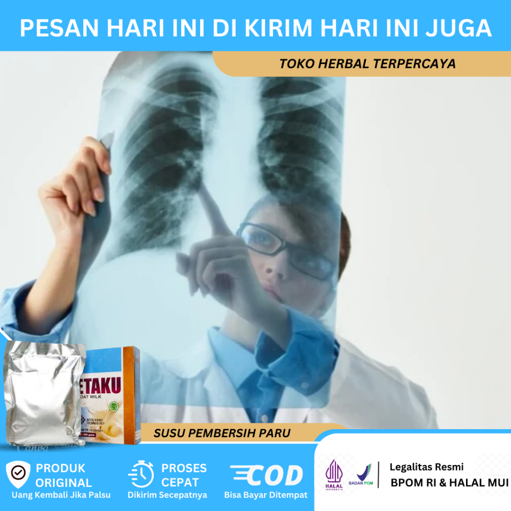 

Susu Pembersih Paru Paru, Susu Atasi Flek Paru Paru, Susu Membersihkan Paru Paru, Susu Untuk TBC Paru Paru, Susu Atasi Sesak Napas, Susu Paru Paru Basah, Susu Menghilangkan Cairan Paru Paru Dengan Walatra Etaku Goat Milk