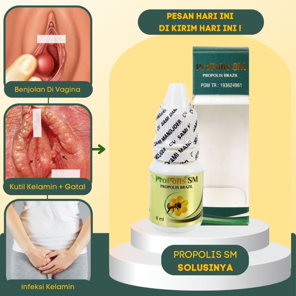 *PRIVASI AMAN* Obat Benjolan Di Miss V - Obat Pengempis Benjolan Pada Kelamin Wanita - Obat Kutil Ke