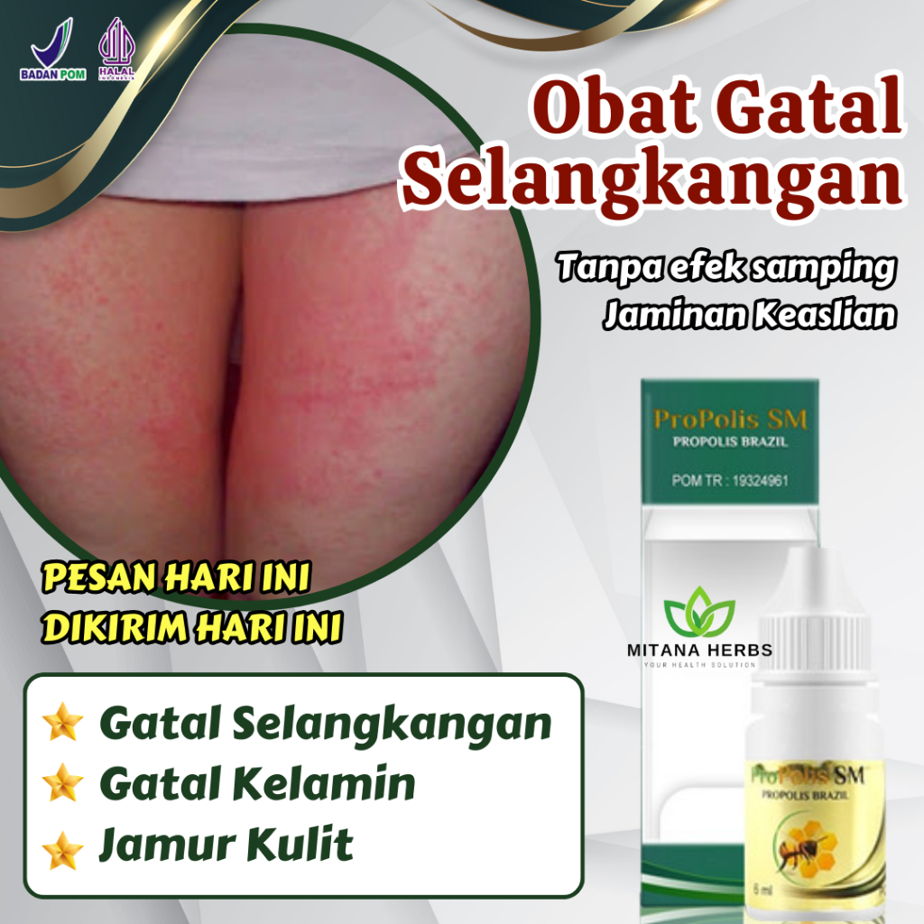 Obat Gatal Selangkangan, Obat Selangkangan Gatal Dan Jamur, Obat Gatal Selangkangan Dan Pantat, Obat