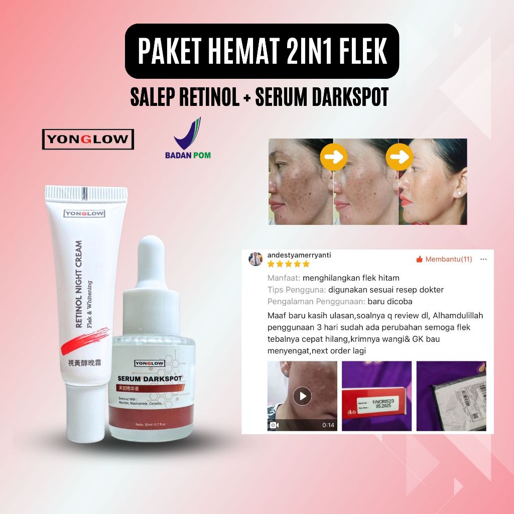 Paket 2in1 BPOM Yonglow Skincare Salep Cina BPOM Flek Hitam Melasm Bintik Bekas Jerawat Serum Darksp