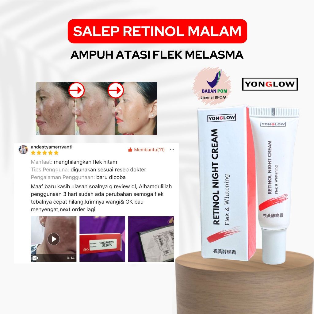 BPOM Yonglow Skincare Salep Cina Flek Salep Malam Flek Noda Hitam Bintik Melasma Wajah Cream Anti Ag