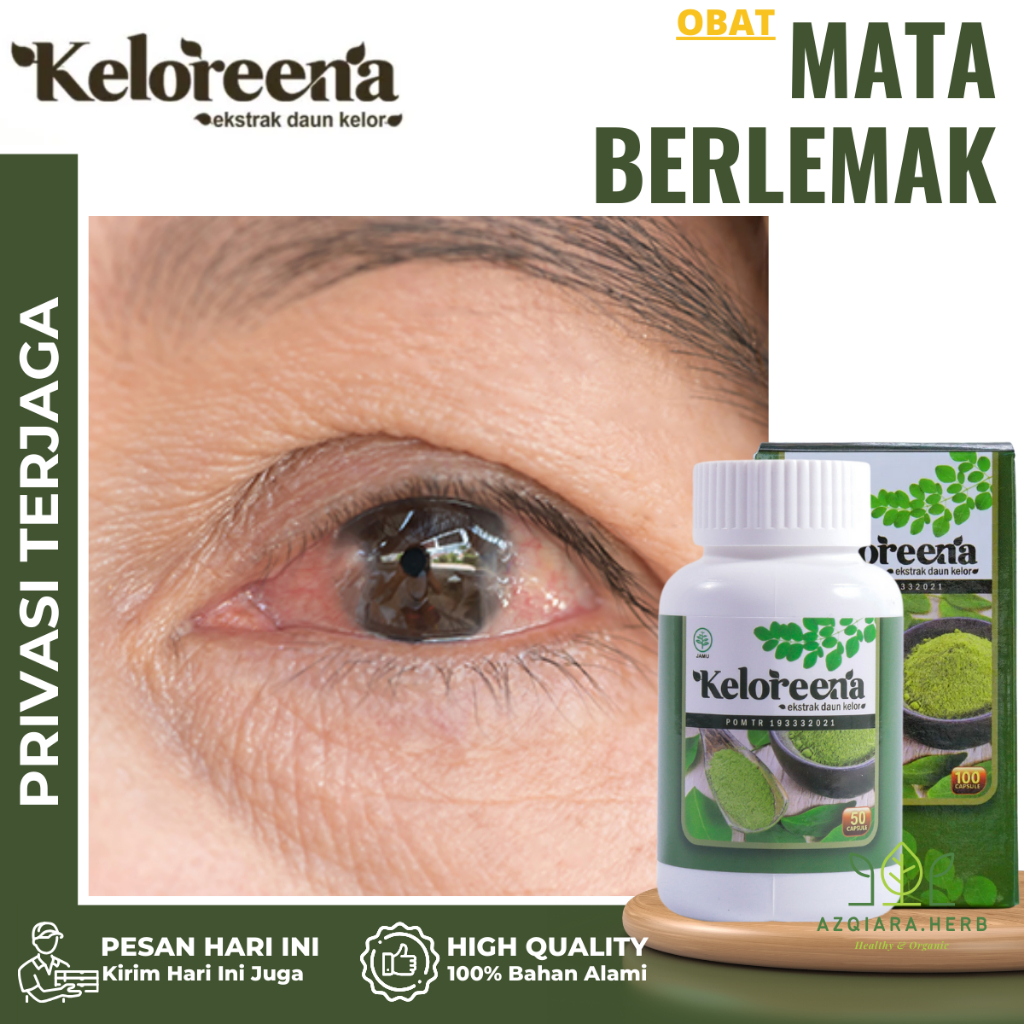 Obat Mata Berlemak, Obat Pterygium, Obat Pembersih Lamad Mata, Obat Penghilang Lemak Mata Kekuningan