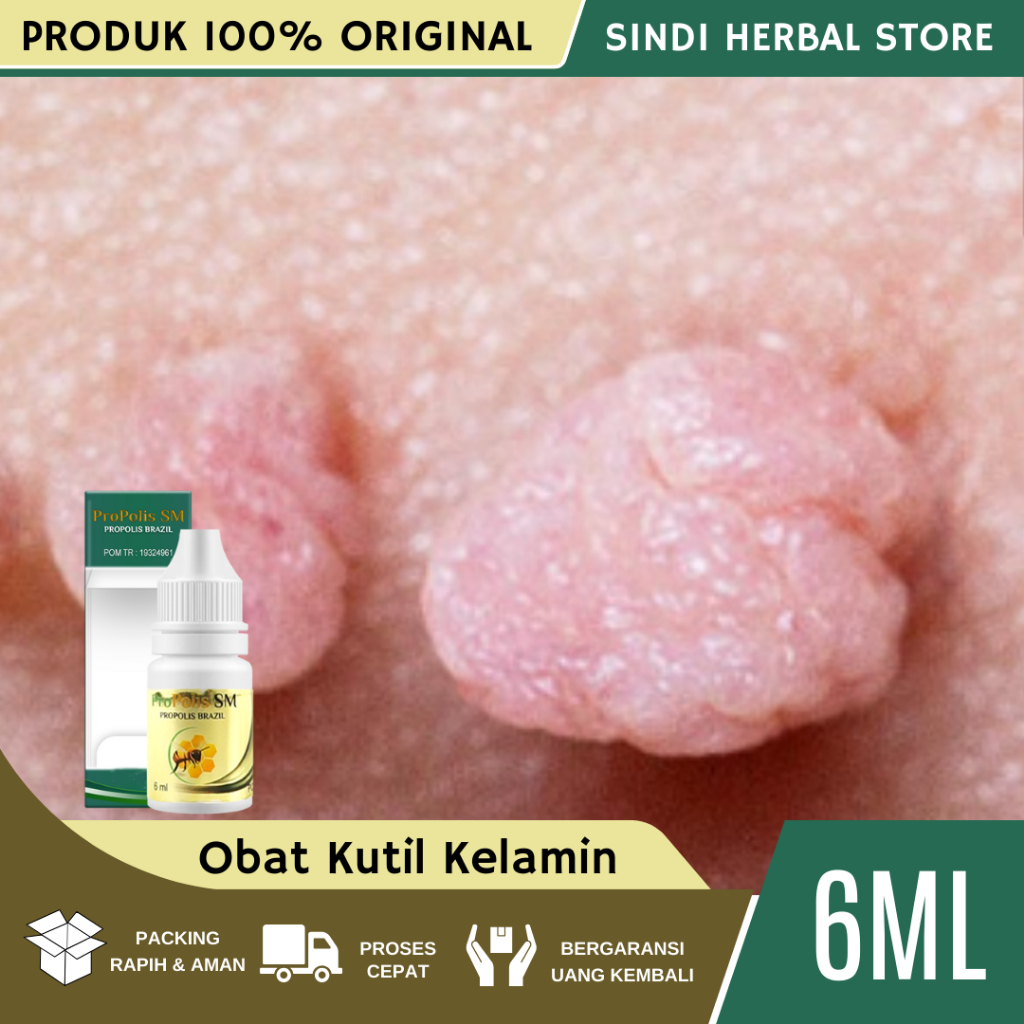 Obat Kutil Kelamin, Obat Kutil Kelamin Pria, Obat Kutil Kelamin Wanita, Obat Kutil Kelamin HPV, Obat