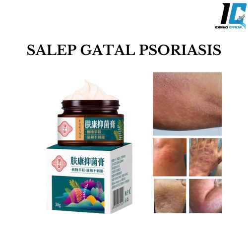 Salep gatal Salep psoriasis Cepat dan efektif Obat Gatal Pantat Dan Selangkangan Obat 30g Psoriasis 