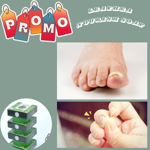 Obat Jamur Kuku Kaki, Obat Jamur Kuku Tangan, Obat Kuku Bau Busuk, Obat Jamur Kuku Tangan Paling Amp