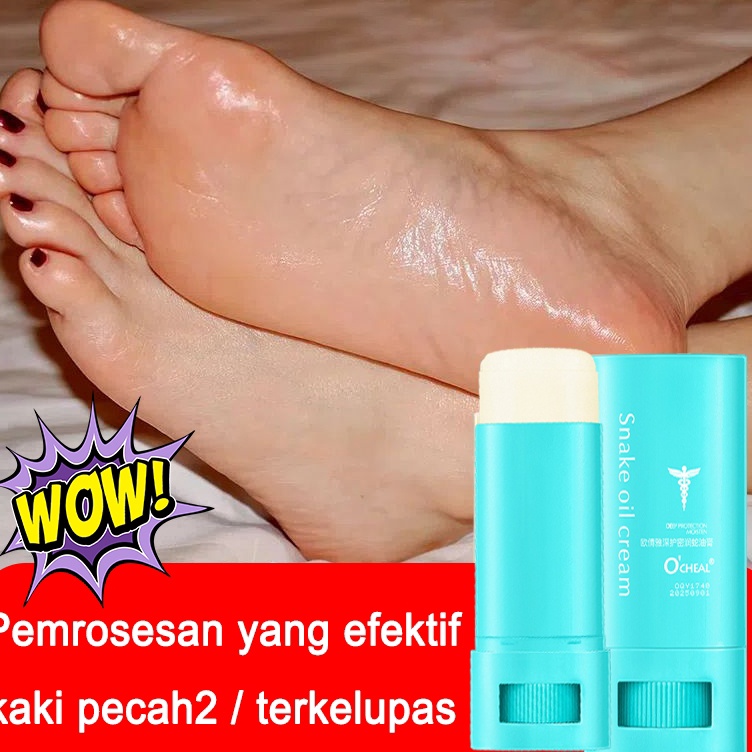 ART C36V vaseline salep kaki pecah dan kering ampuh  penghilang tumit pecah dan kasar  tumit pecah d