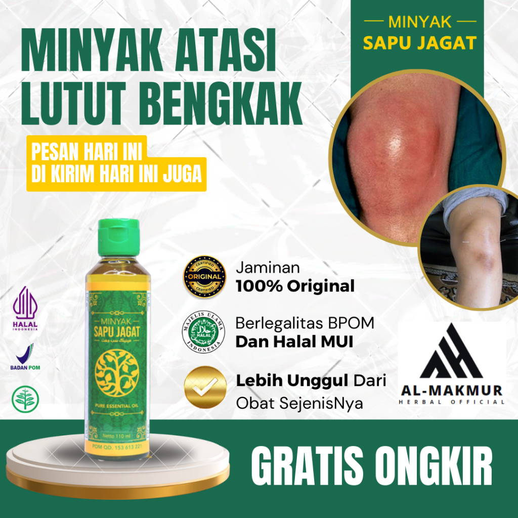 Obat Lutut Bengkak, Obat Lutut Bengkak Sebelah, Obat Radang Sendi, Obat Sakit Lutut, Obat Cedera Lut