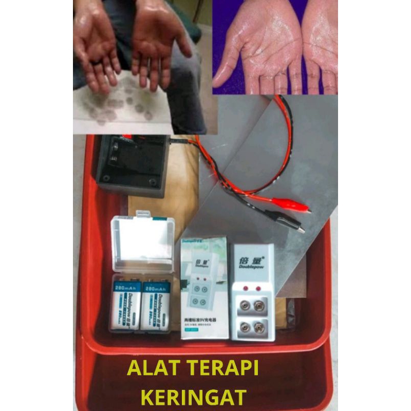 Alat Terapi Therapy Iontophoresis Keringat Kringat Berlebihan Di Telapak Tangan Dan Telapak Kaki Ata