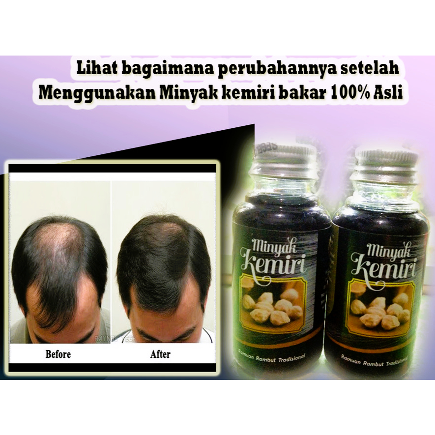 PROMO SARIPATI minyak kemiri bakar asli 100% mencegah kerontokan menghilangkan uban DLL.